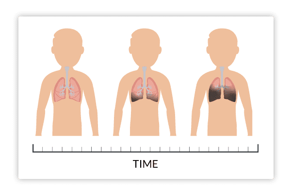 Coal Mine Workers Pneumoconiosis Queensland Coal Board Medical